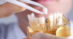 آخرین رتبه قبولی ساخت پروتزهای دندانی دانشگاه سراسری